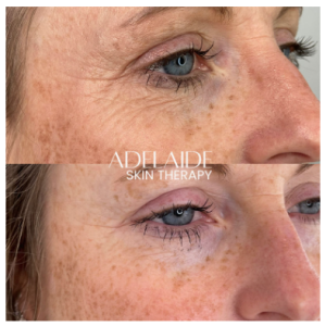 Adelaide Skin Therapy