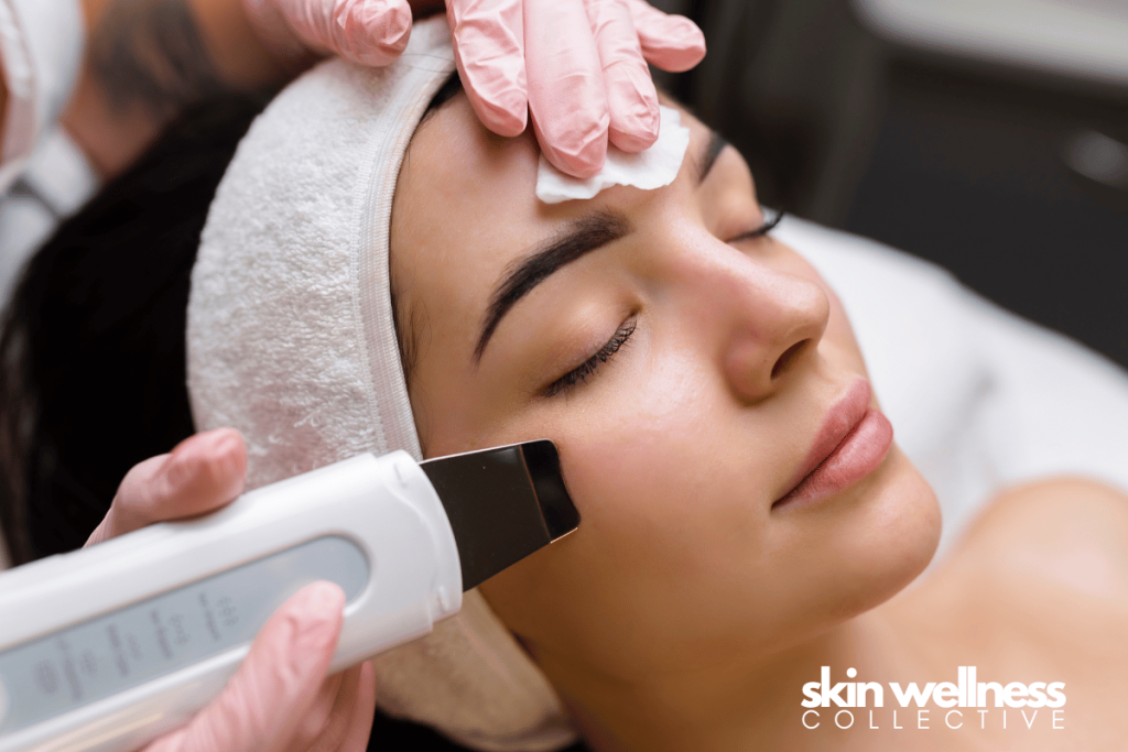 Microdermabrasion treatments locally listed