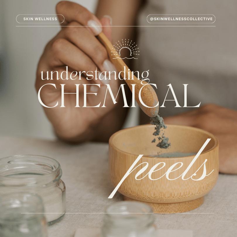 Understanding Chemical peels