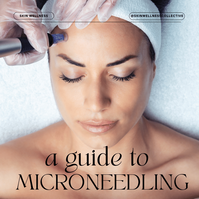 A Guide to microneedling