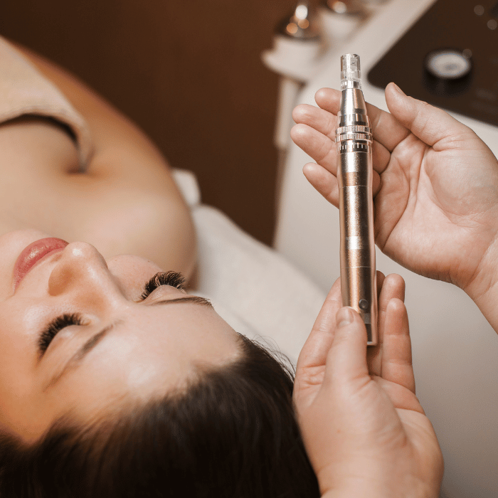 How microneedling works for facial treatment